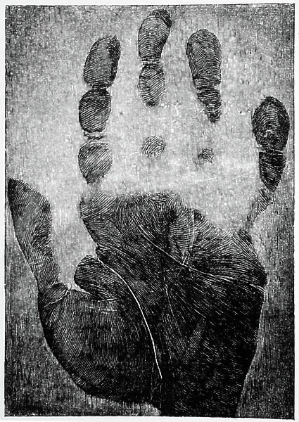 Hand print with reference grid superimposed used to identify criminals, 1892 (photo)