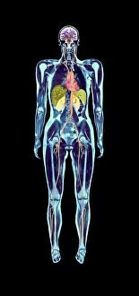 Bones Collection: Full body scan, MRI scan