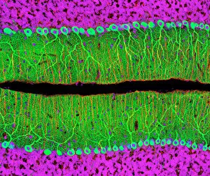 6 Nov 2006 Glass Coaster Collection: Purkinje nerve cells in the cerebellum