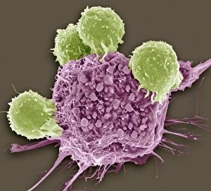 SEM Poster Print Collection: T lymphocytes and cancer cell, SEM C001 / 1679