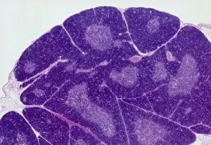Endocrine Collection: Thymus gland, light micrograph C015 / 4970