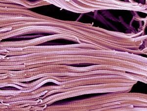 SEM Poster Print Collection: Collagen, Scanning electron micrograph (SEM)