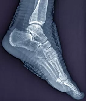 Xray Jigsaw Puzzle Collection: Healthy ankle joint, X-ray